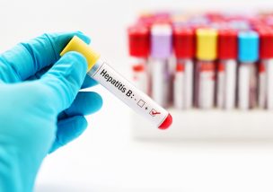 B型肝炎ウイルスの血液検査で陽性反応が出た際の８つの知識と対処法
