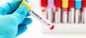 B型肝炎 検査